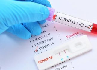 Hari ini, Empat Warga Aceh Selatan Positif Covid-19