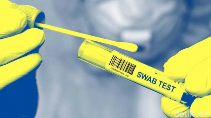 tes-swab_169